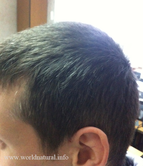 iherb шампунь от перхоти iherb шампунь от перхоти