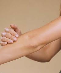 Попробуем смягчить сухие локти